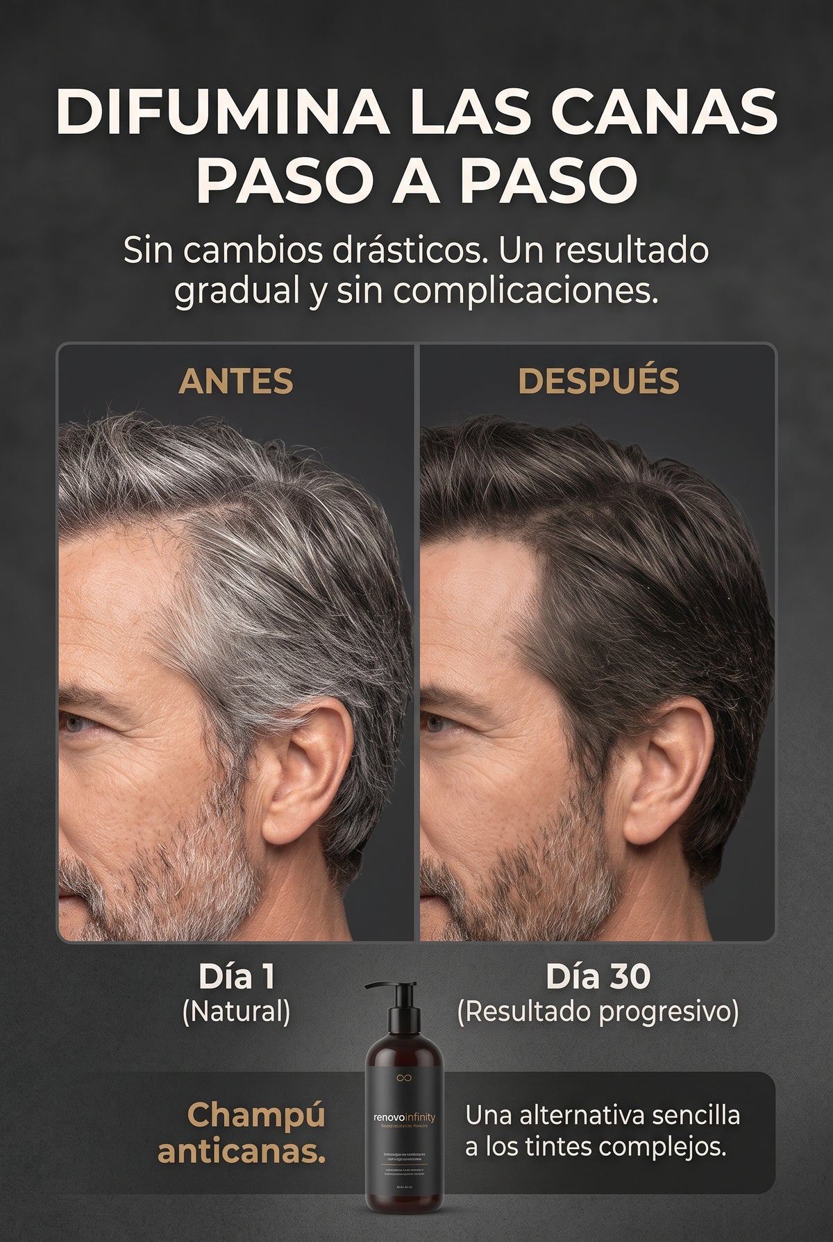 Champú anticanas The Man